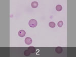 赤血球に寄生したバベシア原虫